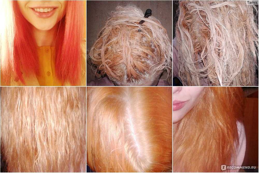 С помощью чего можно осветлить волосы на теле?
